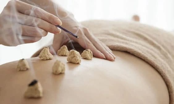 Sesión de Moxibustión en Medicina Tradicional China